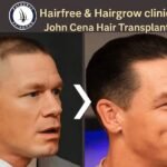 john cena hair transplant